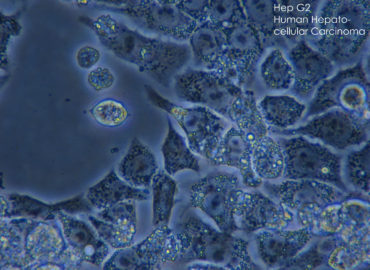 LA CITISINA AVRA’ UN FUTURO ANCHE IN ONCOLOGIA?